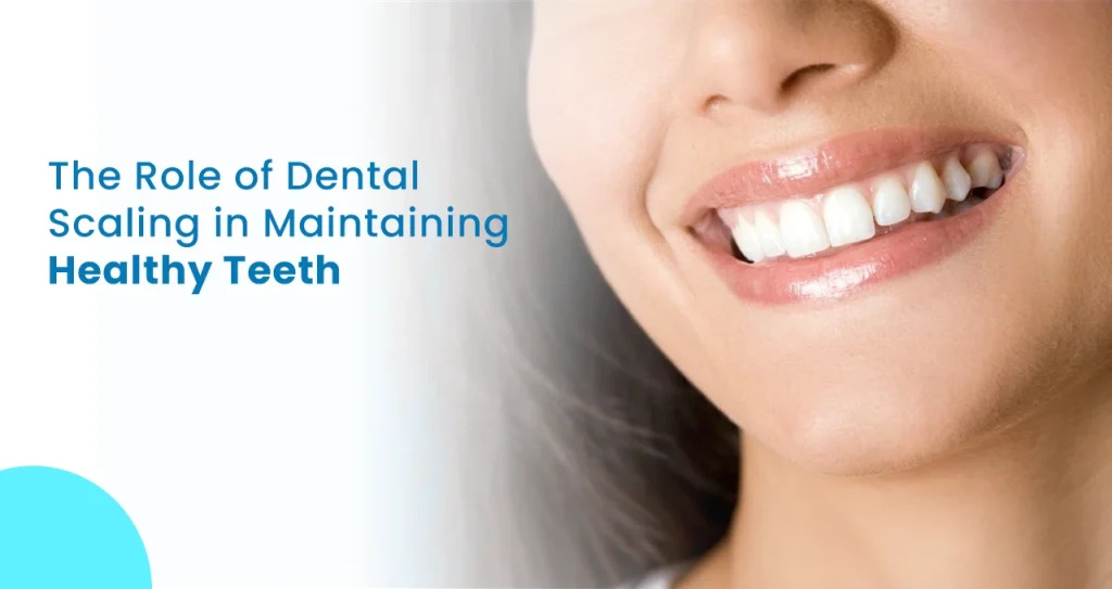 The Role of Dental Scaling in Maintaining Healthy Teeth