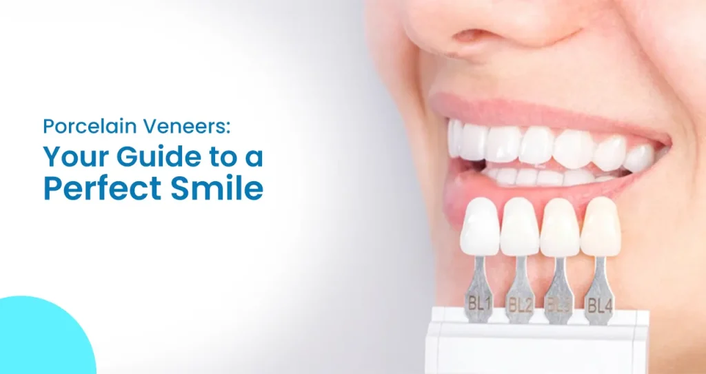 Porcelain Veneers- A Complete Guide to Achieve Your Perfect Smile