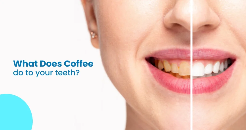 Is Coffee Really the Culprit Behind Your Yellow Teeth