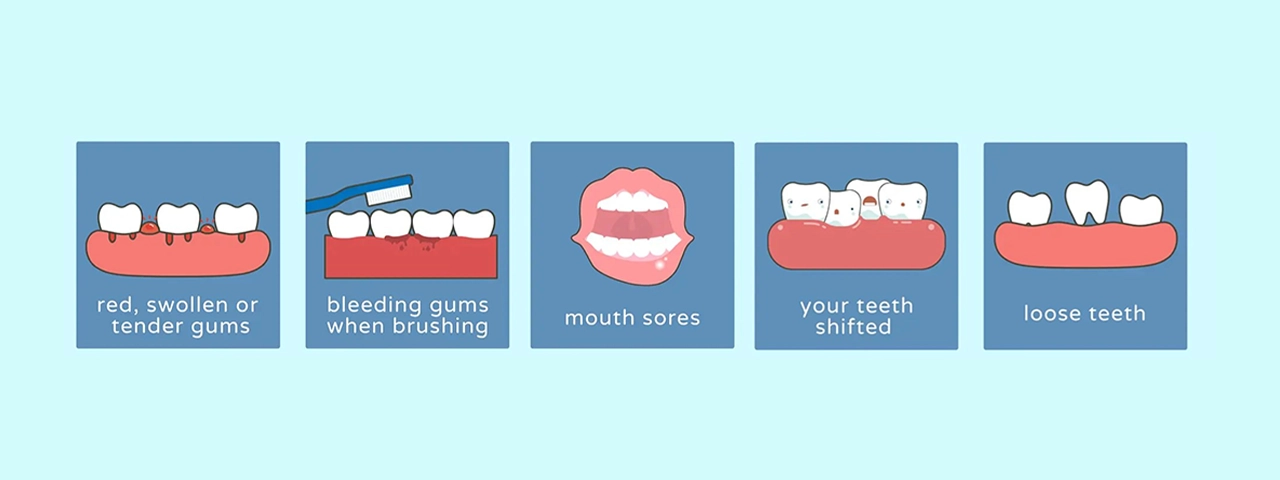 signs of gums bleeding