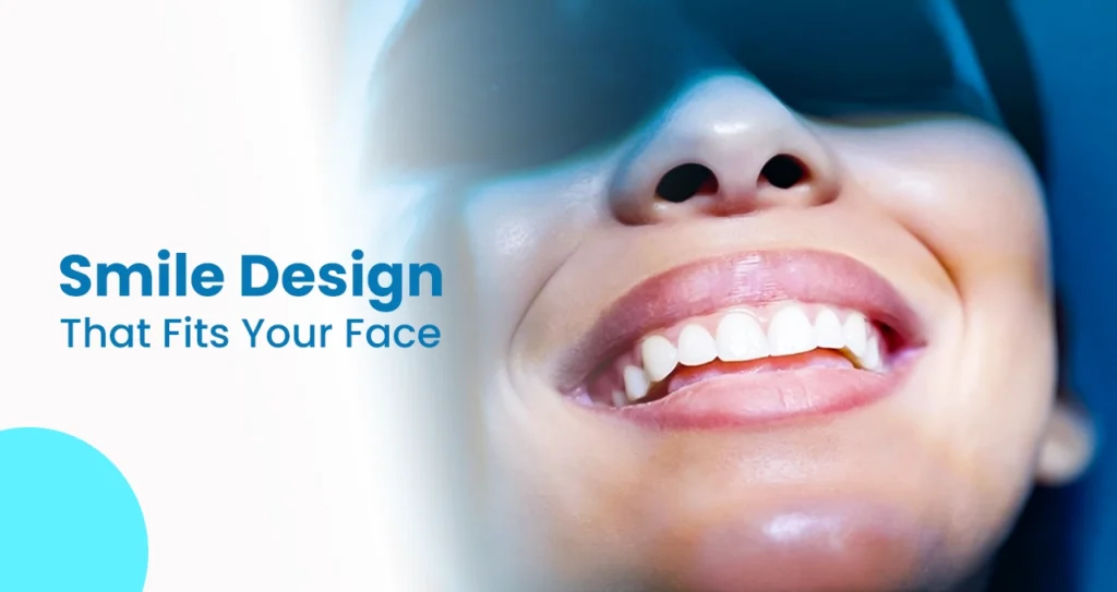 smile design