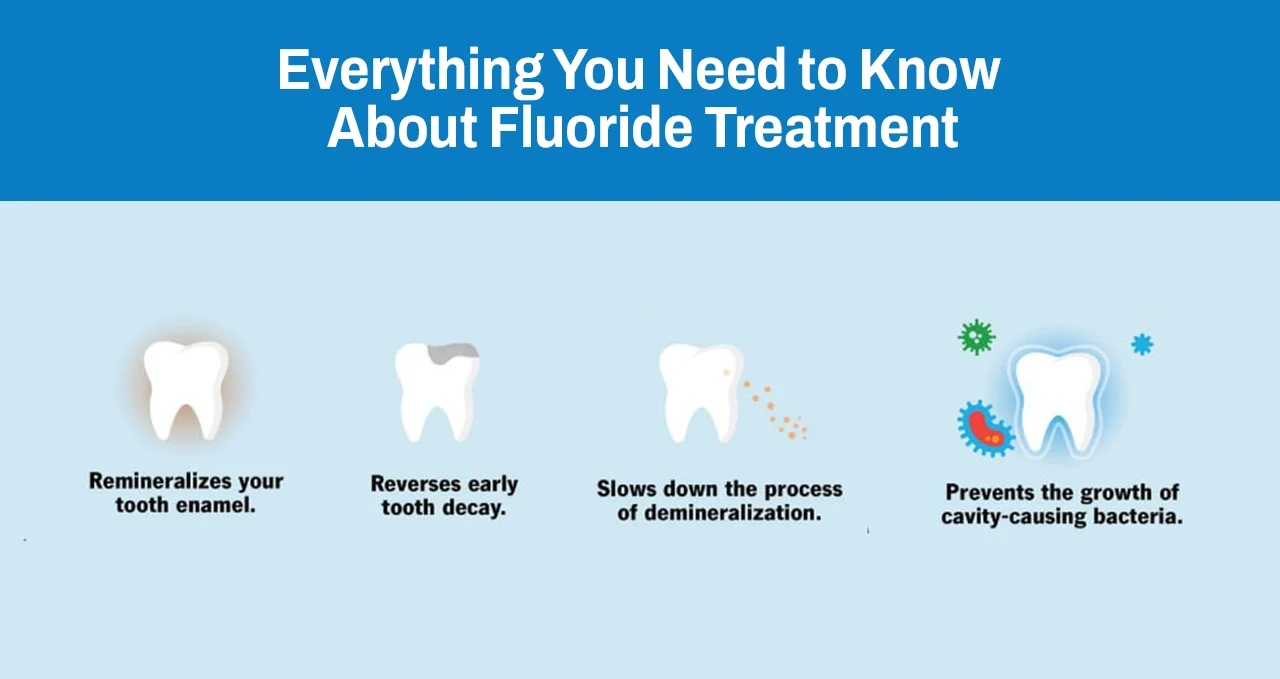 Everything You Need to Know About Fluoride Treatment