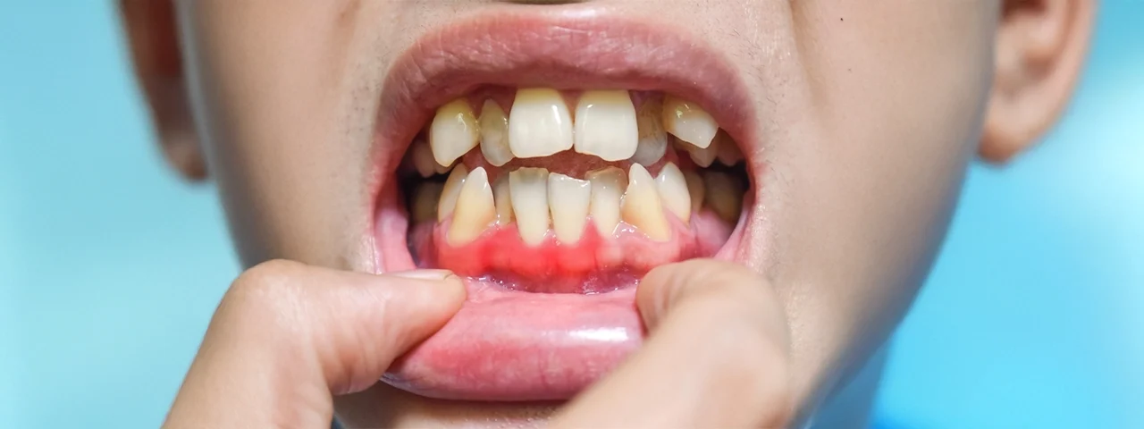 How Poor Oral Hygiene Leads to Serious Health Problems