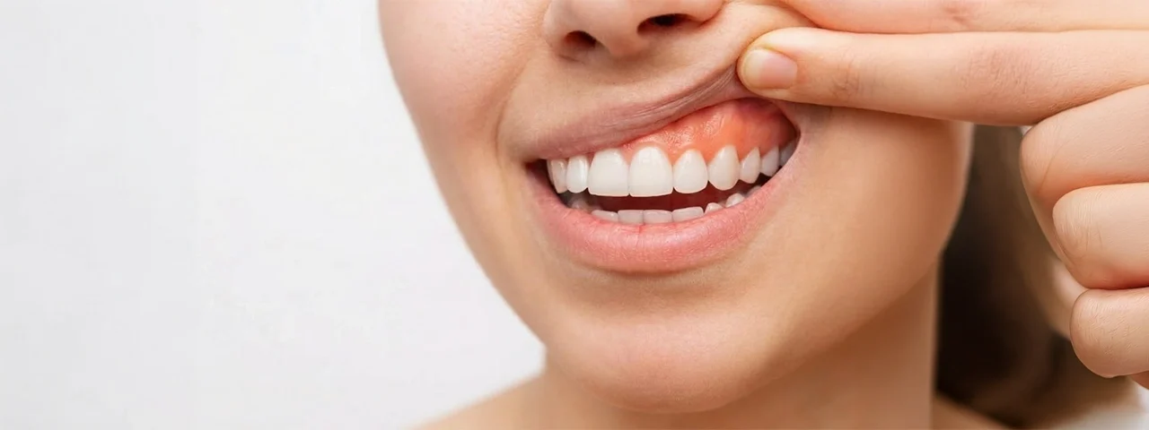 benefits of fluoride for stronger teeth